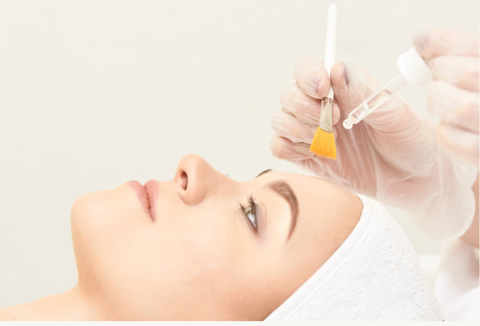 Stacey Chemical Peel