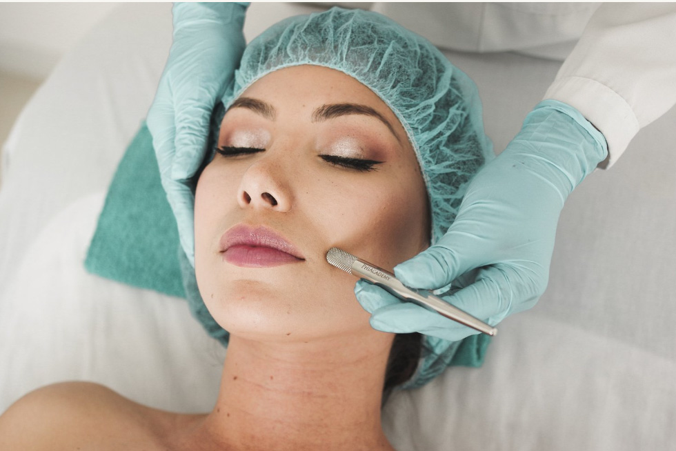 Stacey No Needle Thread Lift